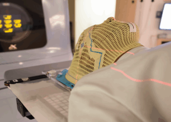 Radioterapia pode ser o único tratamento necessário para tumores de cabeça e pescoço descobertos em fase inicial