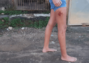 Idoso embriagado e com CNH suspensa bate em muro e atropela menina de 14 anos em Cariacica