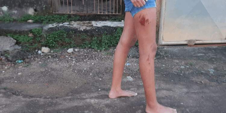 Idoso embriagado e com CNH suspensa bate em muro e atropela menina de 14 anos em Cariacica