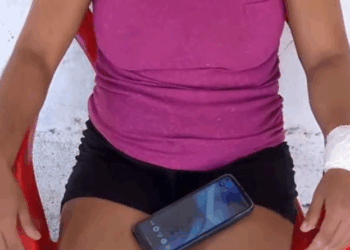 Mulher leva pontos na cabeça e tem braço imobilizado após ser agredida pelo marido