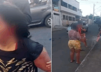 Comerciante tem parte de orelha arrancada durante briga entre mulheres na Serra