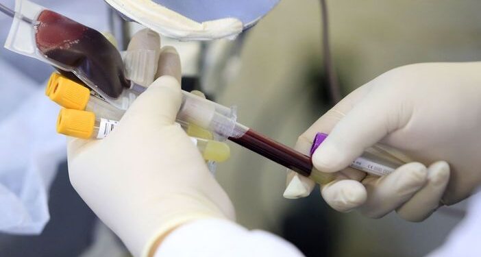 Anemia falciforme, um mal silencioso e perigoso