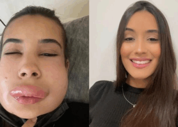 Advogado comenta sobre a gravidade dos erros médicos em procedimentos estéticos