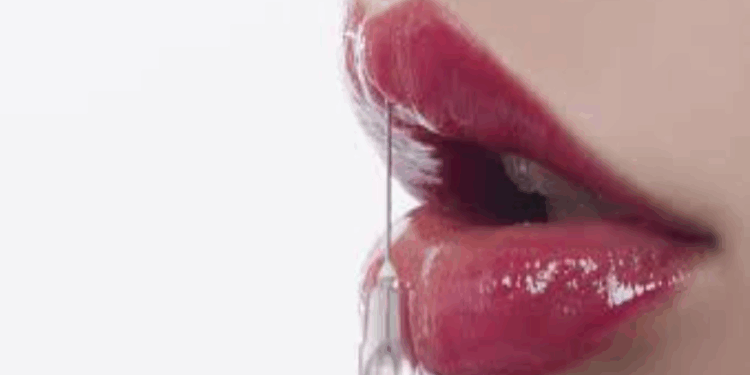 O botox como aliado da odontologia