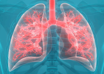 Câncer de pulmão é o mais letal no mundo apesar dos avanços no tratamento e ser uma doença evitável na maioria dos casos