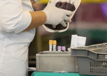 Anemia falciforme foi invisibilizada pelo racismo, mostram entidades