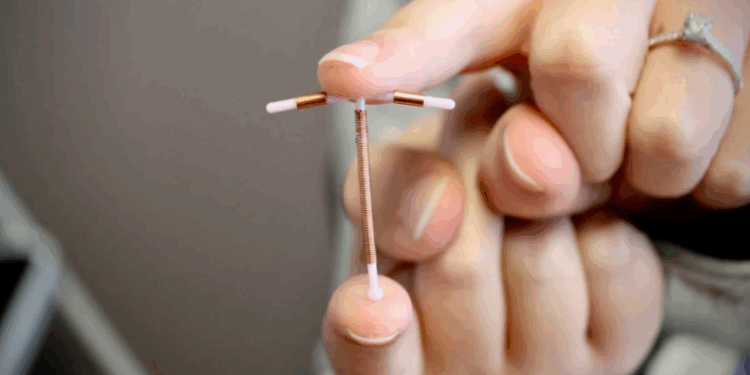 Mais de 600 mulheres receberam implantação de DIU em Vitória