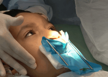 Genética e inflamação na gravidez explicam lábio leporino