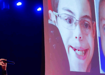 Dia de conscientização busca informar população sobre o lábio leporino