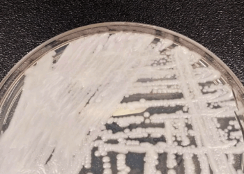 Fiocruz e Pasteur vão pesquisar sobre danos dos fungos no ser humano