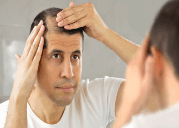 Queda de cabelo: Médico aponta quando o caso é para tratamento