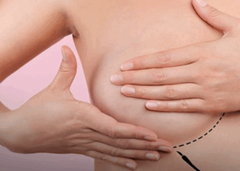 Pesquisadores depositam patente no INPI para tratar câncer de mama