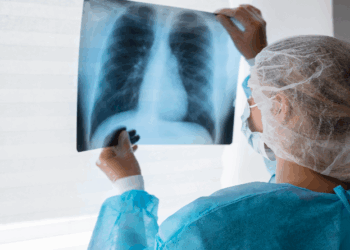 TUBERCULOSE: Brasil está no grupo de países responsáveis por 82% de casos no mundo