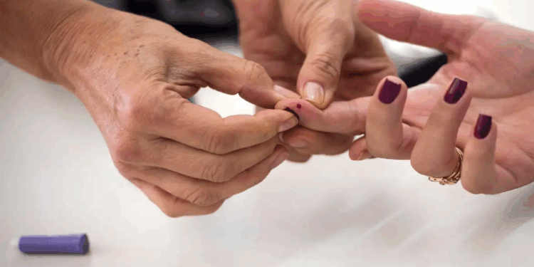 Cuidado cardiovascular deve fazer parte do acompanhamento do diabetes