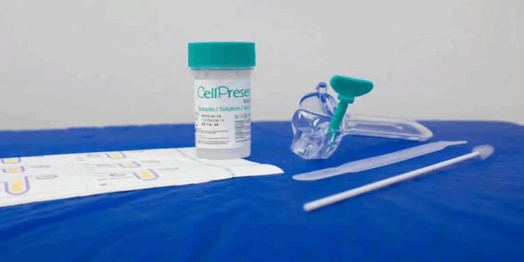 Saiba como é o novo teste do SUS para detectar câncer do colo do útero