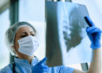 85% dos casos de câncer de pulmão podem ser evitados; entenda