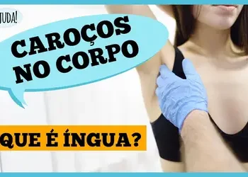 Íngua no pescoço, axila ou virilha? Entenda o que pode ser