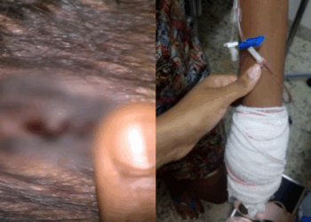 Mulher com bebê no colo é esfaqueada pelo ex-marido em Vila Velha