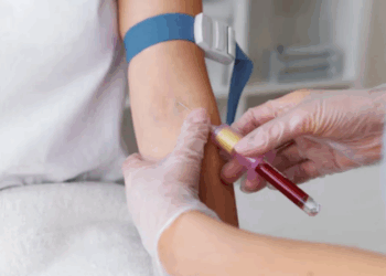 A partir de qual idade crianças e adolescentes devem dosar o colesterol?