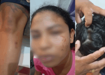 Sobrinha é agredida pelos tios com facão e espeto de churrasco