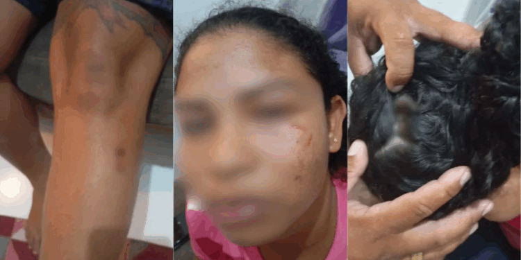 Sobrinha é agredida pelos tios com facão e espeto de churrasco