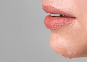Dez dicas de cuidados com os lábios no verão