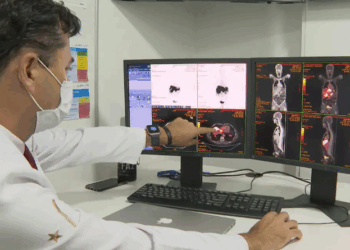 Rastreamento de câncer de intestino identifica lesões em 231 pacientes