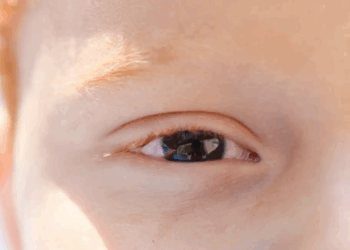 Cartilha sobre saúde ocular na infância orienta pais e professores