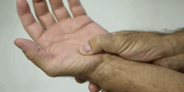 Lei passa a definir fibromialgia como deficiência em todo o país