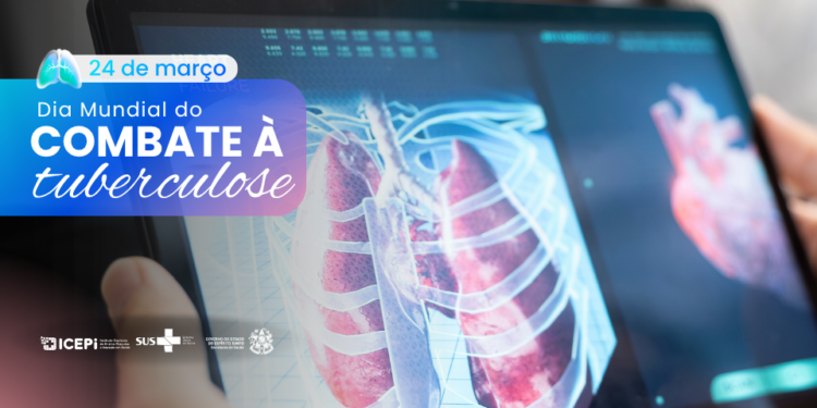 Dia Mundial de Combate à Tuberculose: diagnóstico e tratamento passam pelo cuidado integral na Atenção Primária